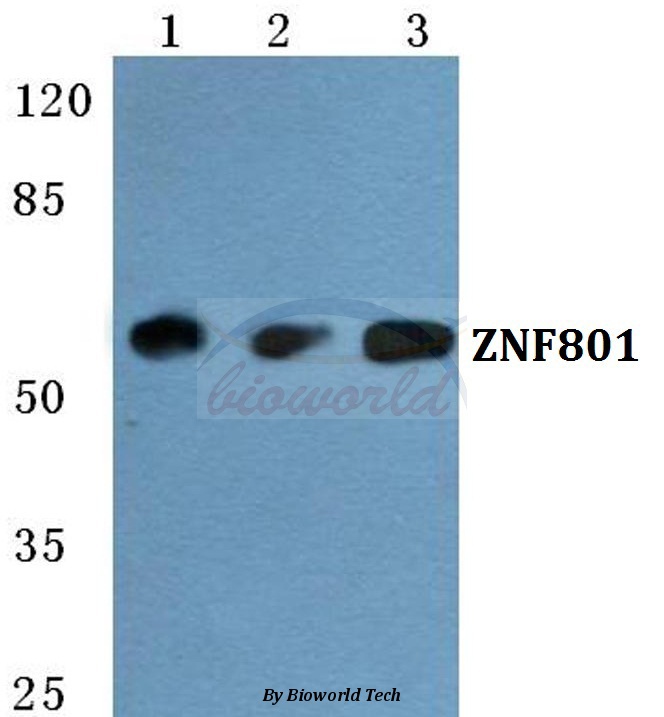 Western blot (WB) analysis of ZNF801 pAb at 1:500 dilution Lane1:MCF-7 cell lysate Lane2:Raw264.7 cell lysate Lane3:PC12 cell lysate