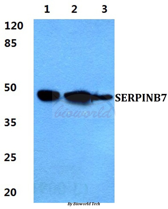 Western blot (WB) analysis of SERPINB7 pAb at 1:500 dilution Lane1:HEK293T cell lysate Lane2:sp2/0 cell lysate Lane3:Rat brain tissue lysate