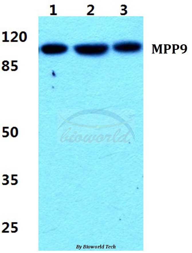 Western blot (WB) analysis of MPP9 pAb at 1:500 dilution Lane1:Hela cell lysate Lane2:NIH-3T3 cell lysate Lane3:PC12 cell lysate