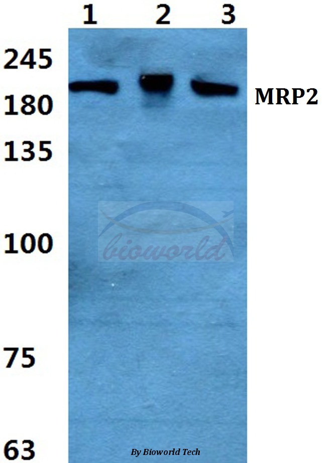 Western blot (WB) analysis of MRP2 pAb at 1:500 dilution Lane1:Hela cell lysate Lane2:Mouse brain tissue lysate Lane3:H9C2 cell lyate