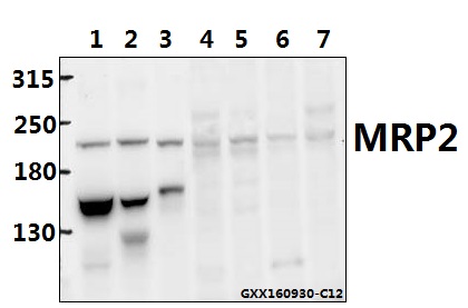 Western blot (WB) analysis of MRP2 pAb at 1:500 dilution Lane1:The Liver tissue lysate of Mouse(40ug) Lane2:The Liver tissue lysate of Rat(40ug) Lane3:The Spleen tissue lysate of Mouse(40ug) Lane4:HepG2 whole cell lysate(40ug) Lane5:L02 whole cell lysate(