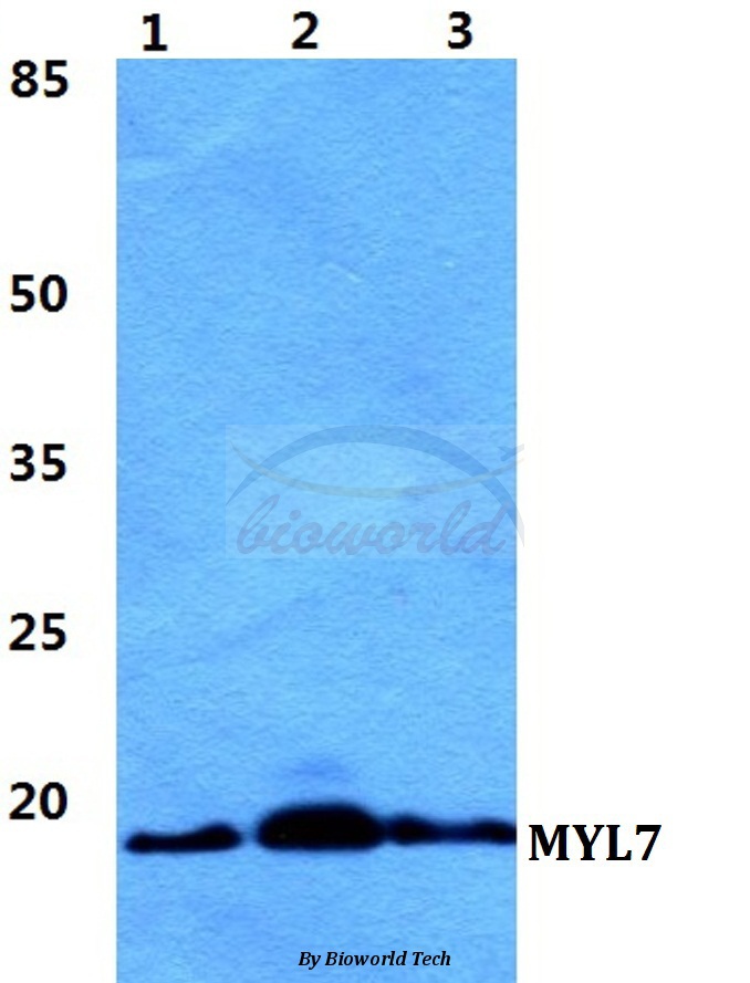 Western blot (WB) analysis of MYL7 pAb at 1:500 dilution Lane1:MCF-7 cell lysate Lane2:sp2/0 cell lysate Lane3:H9C2 cell lysate