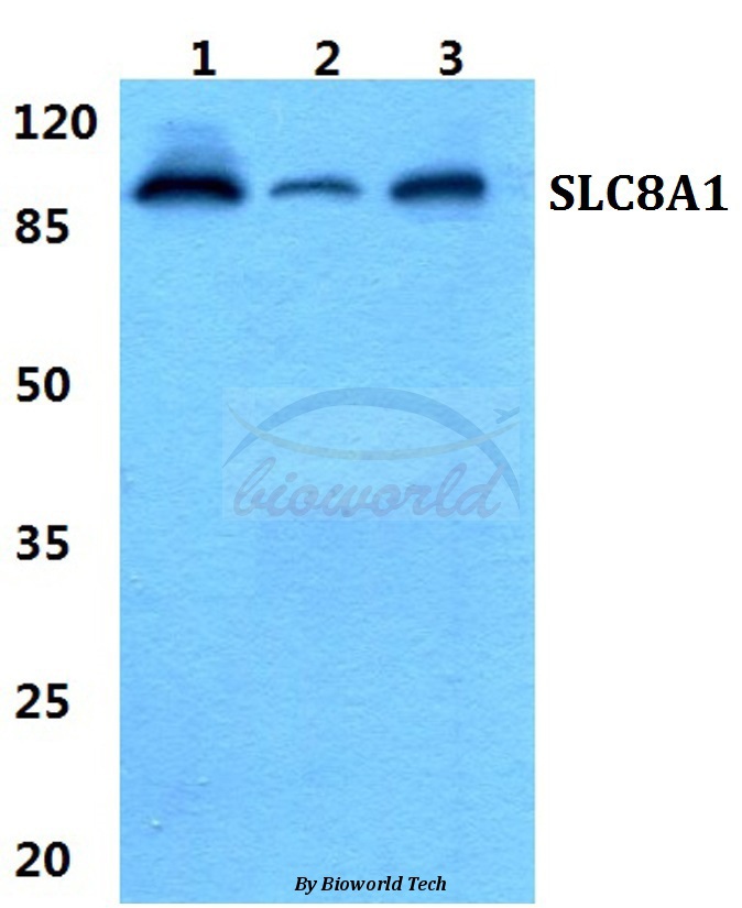 Western blot (WB) analysis of SLC8A1 pAb at 1:500 dilution Lane1:Hela cell lysate Lane2:sp2/0 cell lysate Lane3:PC12 cell lysate