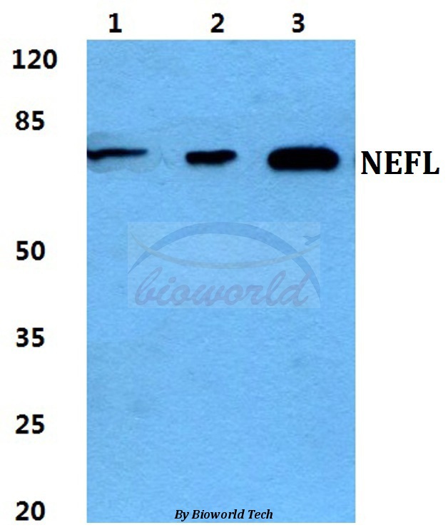 Western blot (WB) analysis of NEFL pAb at 1:500 dilution Lane1:HEK293T cell lysate Lane2:Raw264.7 cell lysate Lane3:H9C2 cell lysate