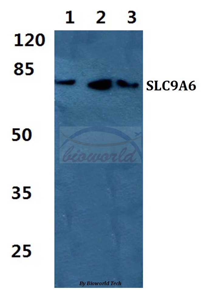 Western blot (WB) analysis of SLC9A6 pAb at 1:500 dilution Lane1:HEK293T cell lysate Lane2:Raw264.7 cell lysate Lane3:PC12 cell lysate