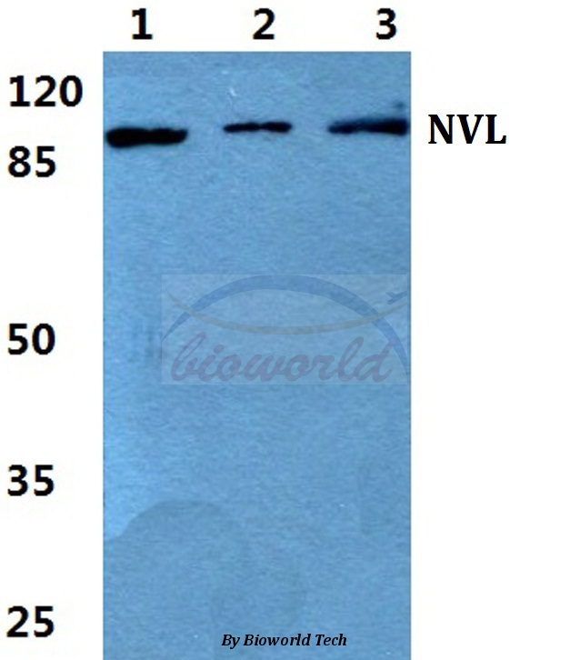 Western blot (WB) analysis of NVL pAb at 1:500 dilution Lane1:A549 cell lysate Lane2:Raw264.7 cell lysate Lane3:H9C2 cell lysate