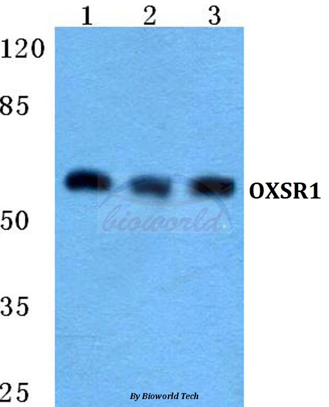 Western blot (WB) analysis of OXSR1 pAb at 1:500 dilution Lane1:Hela cell lysate Lane2:sp2/0 cell lysate Lane3:PC12 cell lysate