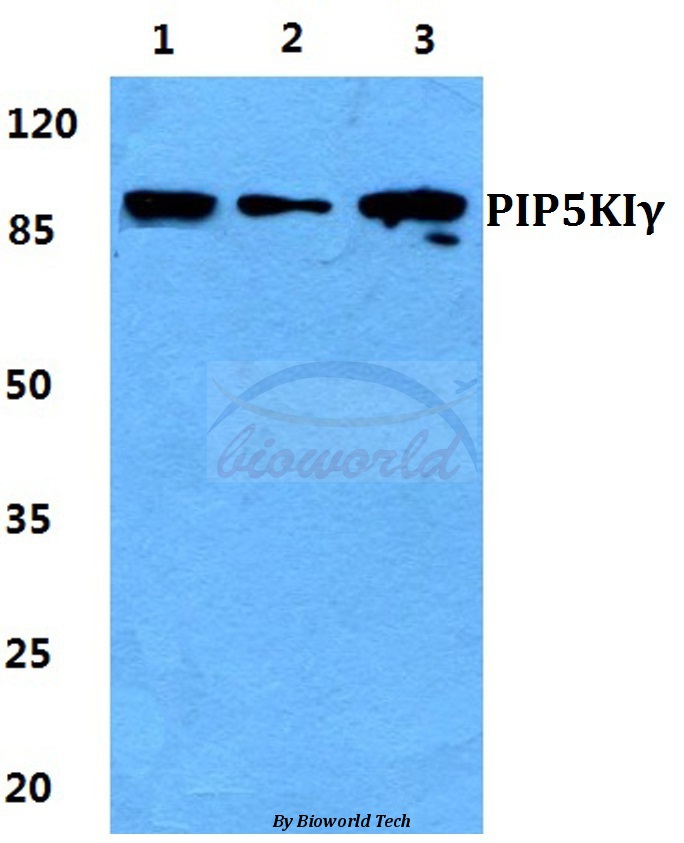 Western blot (WB) analysis of PIP5KIγ pAb at 1:500 dilution Lane1:Hela cell lysate Lane2:Raw264.7 cell lysate Lane3:PC12 cell lysate