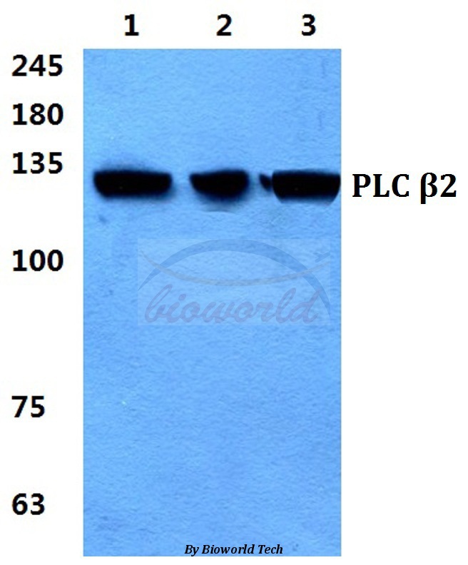 Western blot (WB) analysis of PLC β2 pAb at 1:500 dilution Lane1:Hela cell lysate Lane2:sp2/0 cell lysate Lane3:H9C2 cell lysate