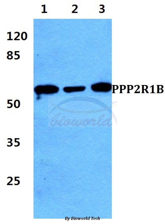 Western blot (WB) analysis of PPP2R1B pAb at 1:500 dilution Lane1:Hela cell lysate Lane2:Raw264.7 cell lysate Lane3:H9C2 cell lysate