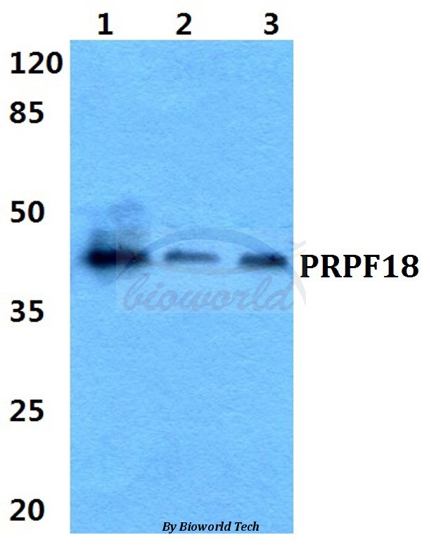 Western blot (WB) analysis of PRPF18 pAb at 1:500 dilution Lane1:HEK29T cell lysate Lane2:sp2/0 cell lysate Lane3:H9C2 cell lysate
