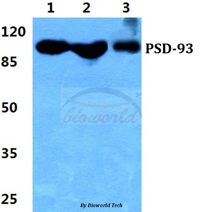 Western blot (WB) analysis of PSD-93 pAb at 1:500 dilution Lane1:Hela cell lysate Lane2:NIH-3T3 cell lysate Lane3:PC12 cell lysate