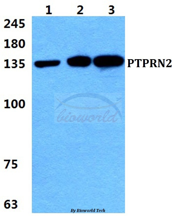 Western blot (WB) analysis of PTPRN2 pAb at 1:500 dilution Lane1:Hela cell lysate Lane2:sp2/0 cell lysate Lane3:H9C2 cell lysate