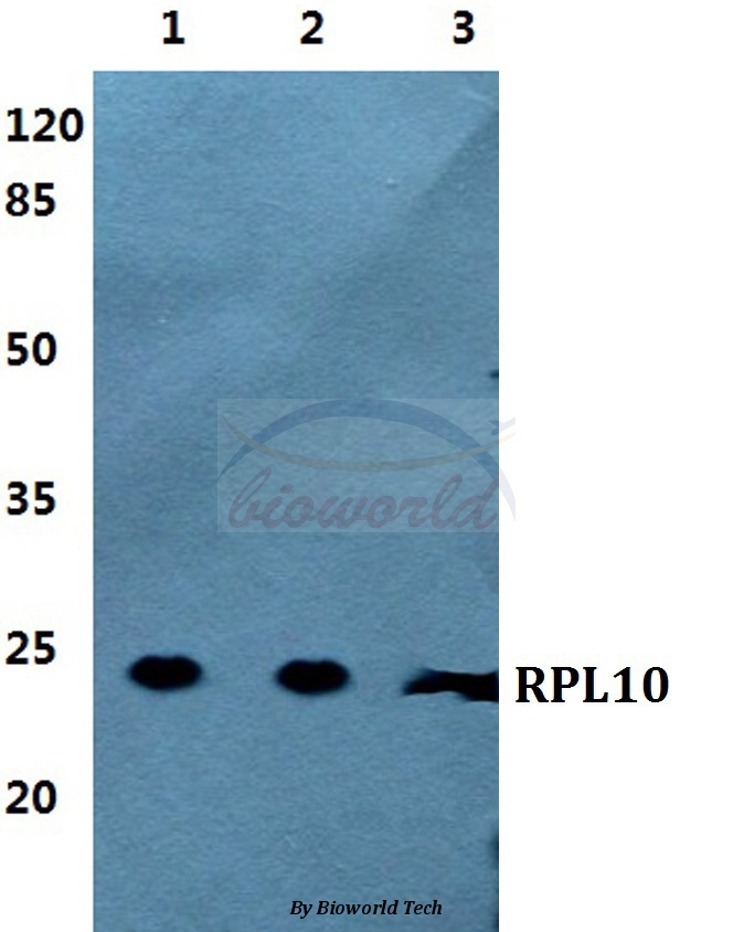 Western blot (WB) analysis of RPL10 pAb at 1:500 dilution Lane1:MCF-7 cell lysate Lane2:Raw264.7 cell lysate Lane3:PC12 cell lysate