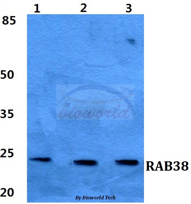 Western blot (WB) analysis of RAB38 pAb at 1:500 dilution Lane1:MCF-7 cell lysate Lane2:sp2/0 cell lysate Lane3:PC12 cell lyate