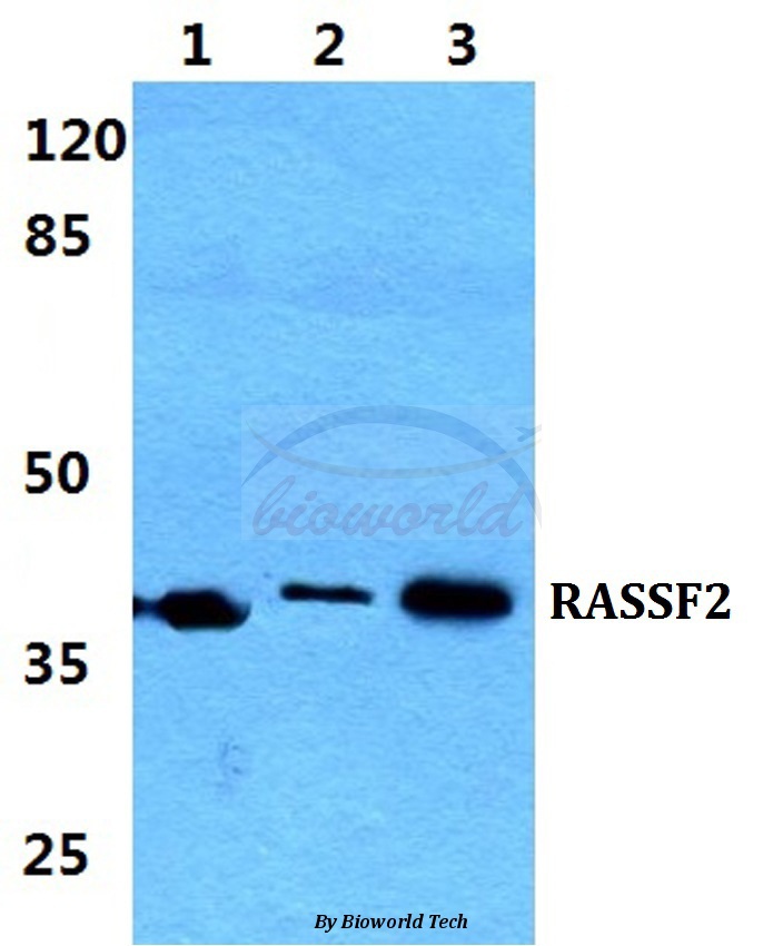 Western blot (WB) analysis of RASSF2 pAb at 1:500 dilution Lane1:Hela cell lysate Lane2:NIH-3T3 cell lysate Lane3:H9C2 cell lysate
