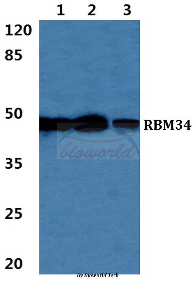 Western blot (WB) analysis of RBM34 pAb at 1:500 dilution Lane1:MCF-7 cell lysate Lane2:Mouse liver tissue lysate Lane3:H9C2 cell lyate