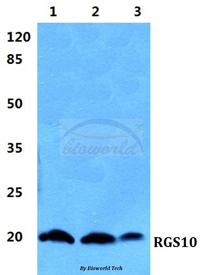 Western blot (WB) analysis of RGS10 pAb at 1:500 dilution Lane1:Hela cell lysate Lane2:Raw264.7 cell lysate Lane3:H9C2 cell lysate