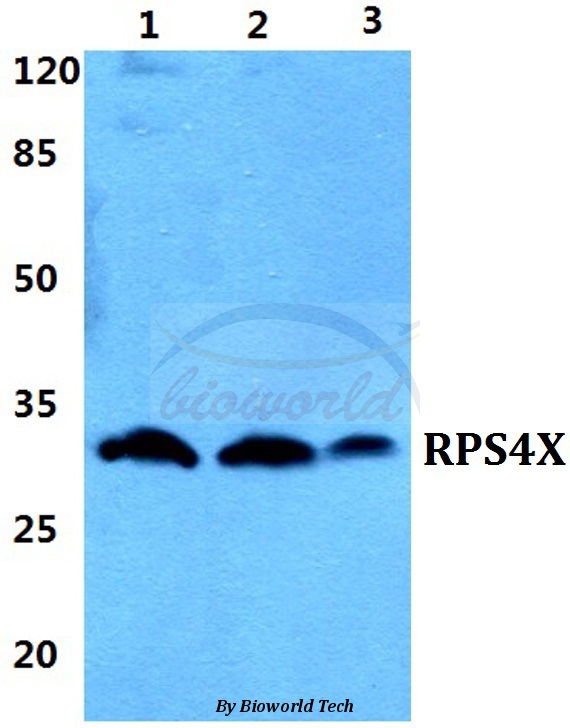 Western blot (WB) analysis of RPS4X pAb at 1:500 dilution Lane1:Hela cell lysate Lane2:sp2/0 cell lysate Lane3:H9C2 cell lysate