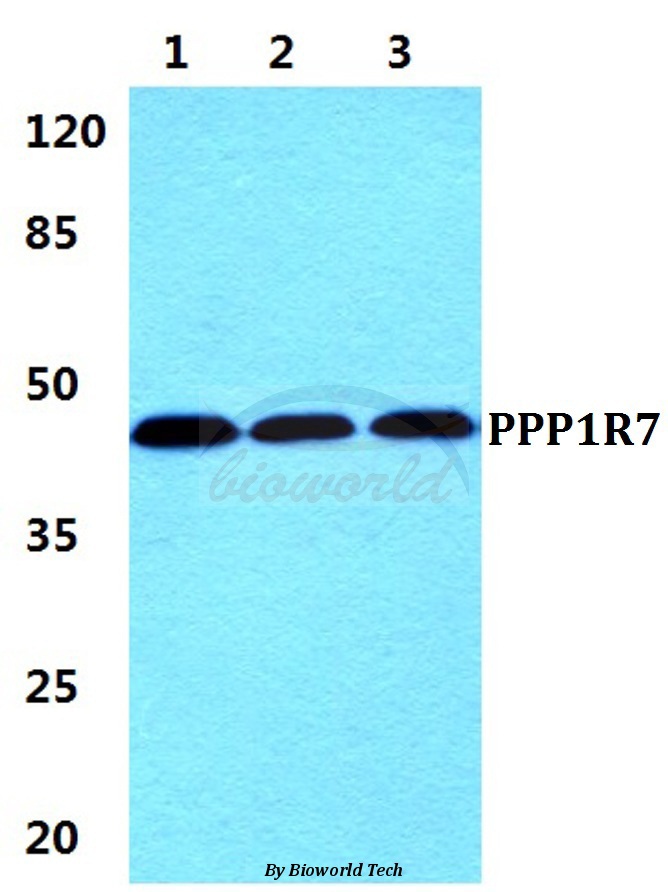 Western blot (WB) analysis of PPP1R7 pAb at 1:500 dilution Lane1:Hela cell lysate Lane2:Raw264.7 cell lysate Lane3:H9C2 cell lysate