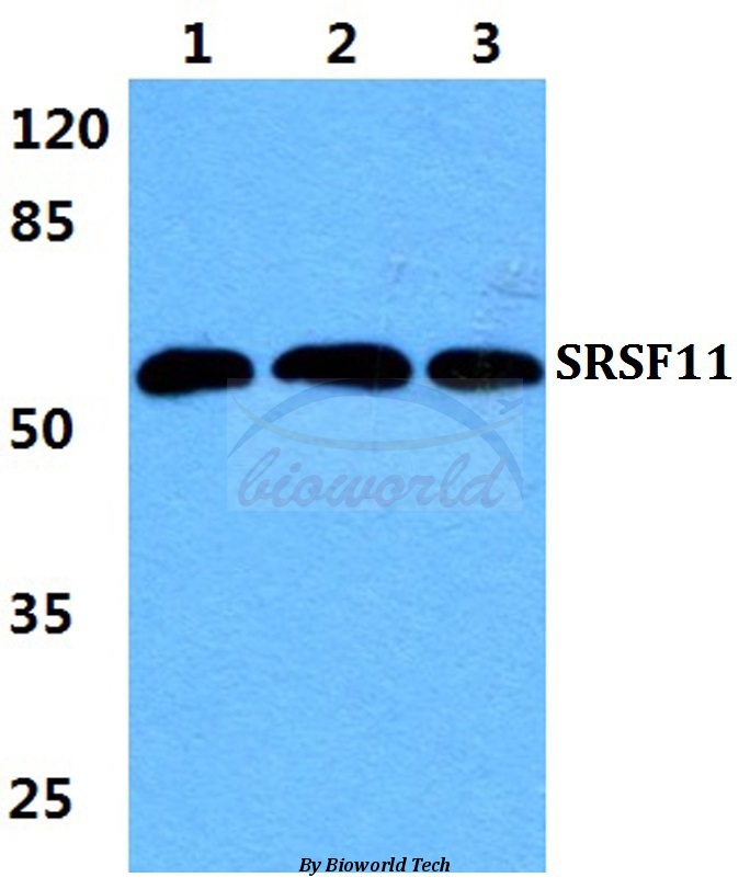Western blot (WB) analysis of SRSF11 pAb at 1:500 dilution Lane1:Hela cell lysate Lane2:sp2/0 cell lysate Lane3:H9C2 cell lysate