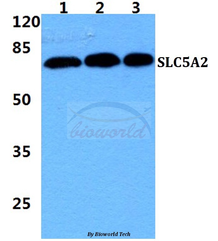 Western blot (WB) analysis of SLC5A2 pAb at 1:500 dilution Lane1:Hela cell lysate Lane2:sp2/0 cell lysate Lane3:H9C2 cell lysate