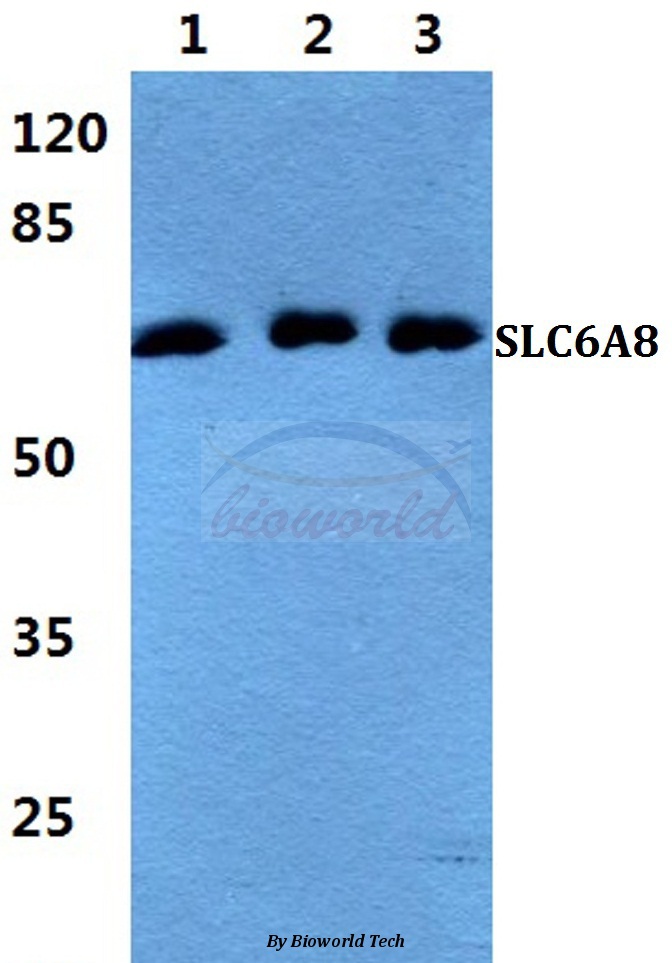 Western blot (WB) analysis of SLC6A8 pAb at 1:500 dilution Lane1:HEK293T cell lysate Lane2:Raw264.7 cell lysate Lane3:H9C2 cell lysate