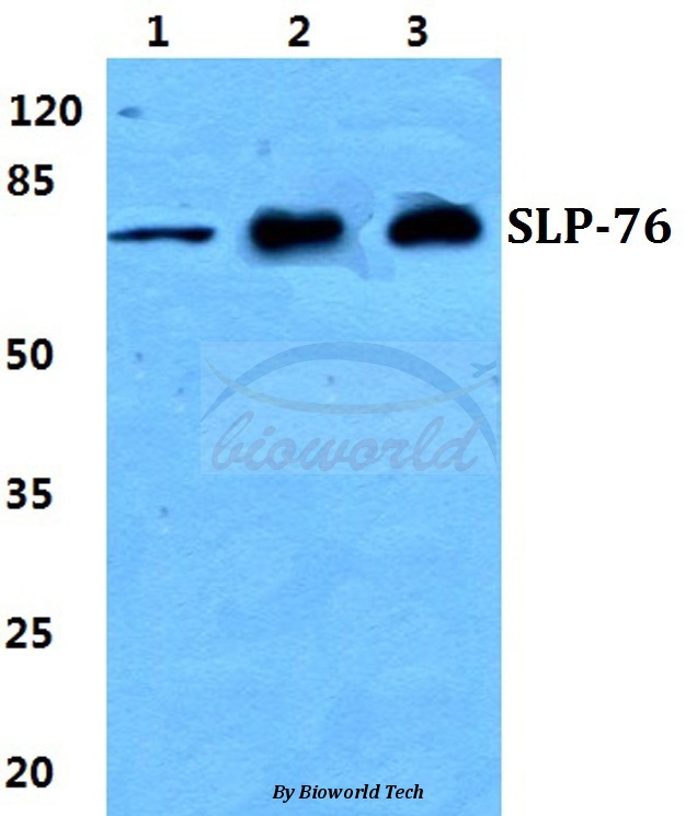 Western blot (WB) analysis of SLP-76 pAb at 1:500 dilution Lane1:HEK293T cell lysate Lane2:sp2/0 cell lysate Lane3:H9C2 cell lysate
