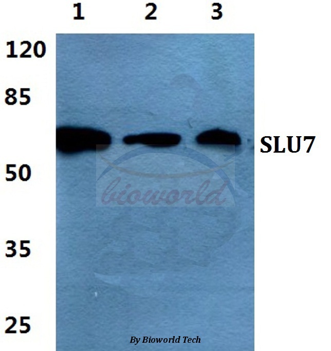 Western blot (WB) analysis of SLU7 pAb at 1:500 dilution Lane1:A549 cell lysate Lane2:sp2/0 cell lysate Lane3:PC12 cell lysate