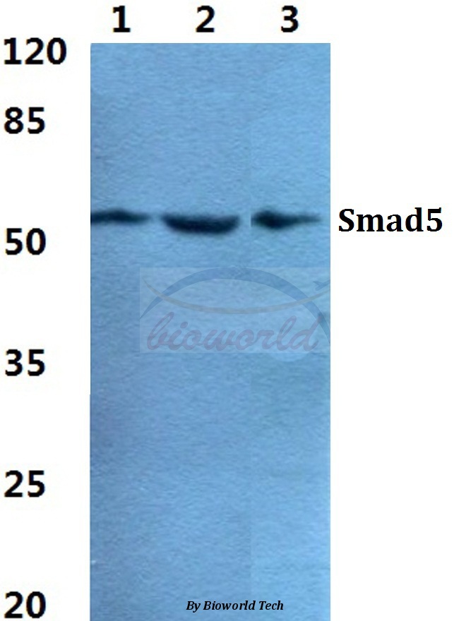 Western blot (WB) analysis of Smad5 pAb at 1:500 dilution Lane1:A549 cell lysate Lane2:sp2/0 cell lysate Lane3:PC12 cell lysate