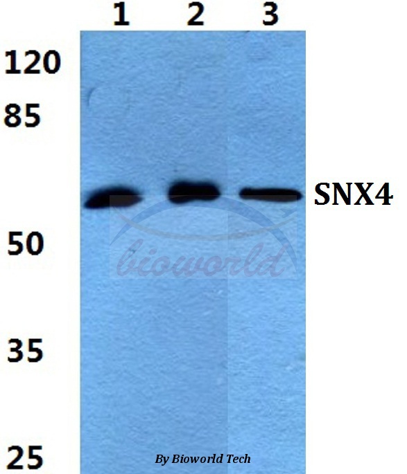 Western blot (WB) analysis of SNX4 pAb at 1:500 dilution Lane1:A549 cell lysate Lane2:Raw264.7 cell lysate Lane3:PC12 cell lysate
