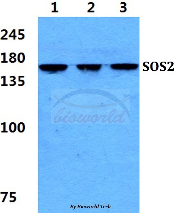 Western blot (WB) analysis of SOS2 pAb at 1:500 dilution Lane1:Hela cell lysate Lane2:sp2/0 cell lysate Lane3:H9C2 cell lysate