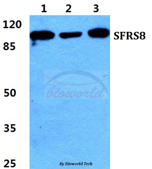 Western blot (WB) analysis of SFRS8 pAb at 1:500 dilution Lane1:Hela cell lysate Lane2:sp2/0 cell lysate Lane3:PC12 cell lysate