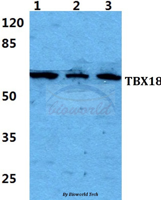 Western blot (WB) analysis of TBX18 pAb at 1:500 dilution Lane1:HEK293T cell lysate Lane2:NIH-3T3 cell lysate Lane3:PC12 cell lysate