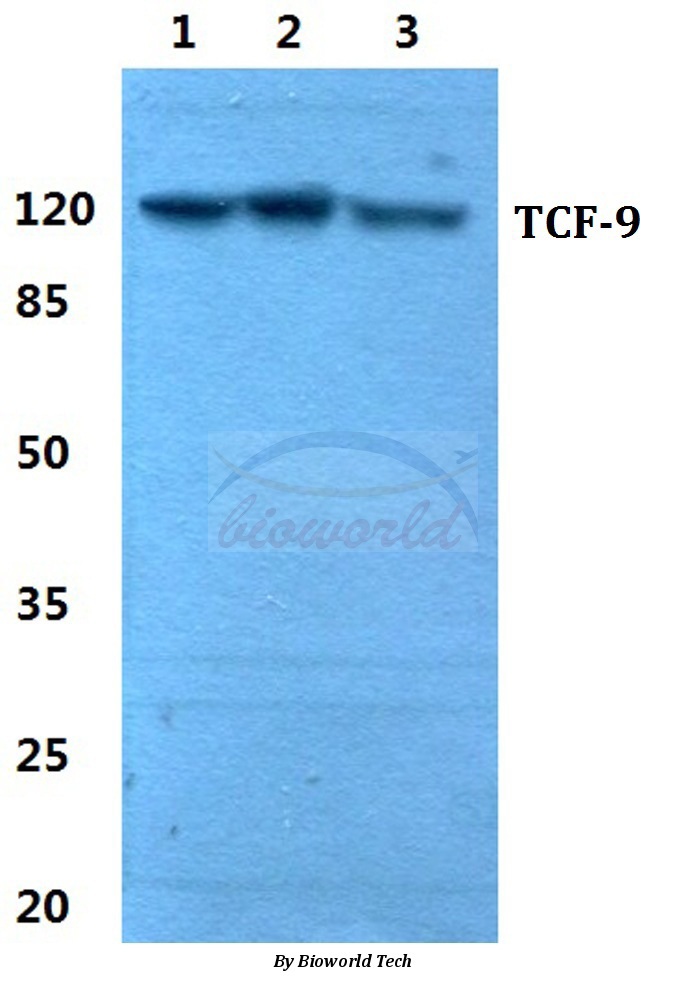 Western blot (WB) analysis of TCF-9 pAb at 1:500 dilution Lane1:Hela cell lysate Lane2:sp2/0 cell lysate Lane3:PC12 cell lysate