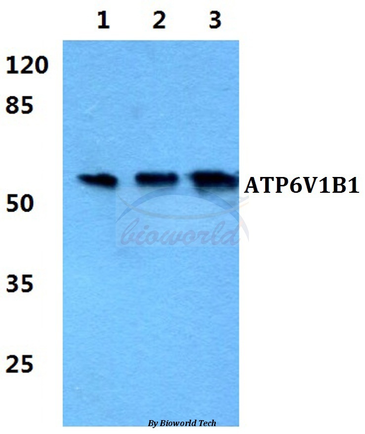Western blot (WB) analysis of ATP6V1B1 pAb at 1:500 dilution Lane1:HEK293T cell lysate Lane2:Raw264.7 cell lysate Lane3:PC12 cell lysate