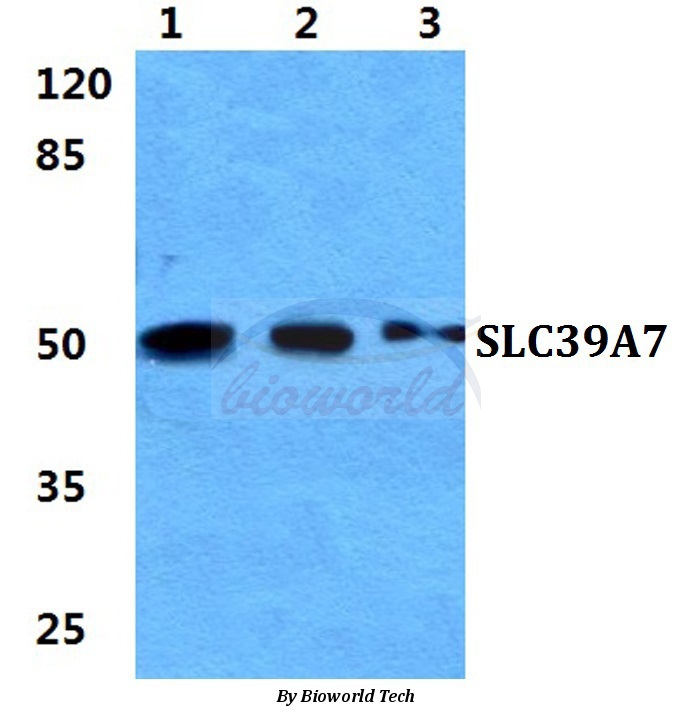 Western blot (WB) analysis of SLC39A7 pAb at 1:500 dilution Lane1:Hela cell lysate Lane2:sp2/0 cell lysate Lane3:H9C2 cell lysate