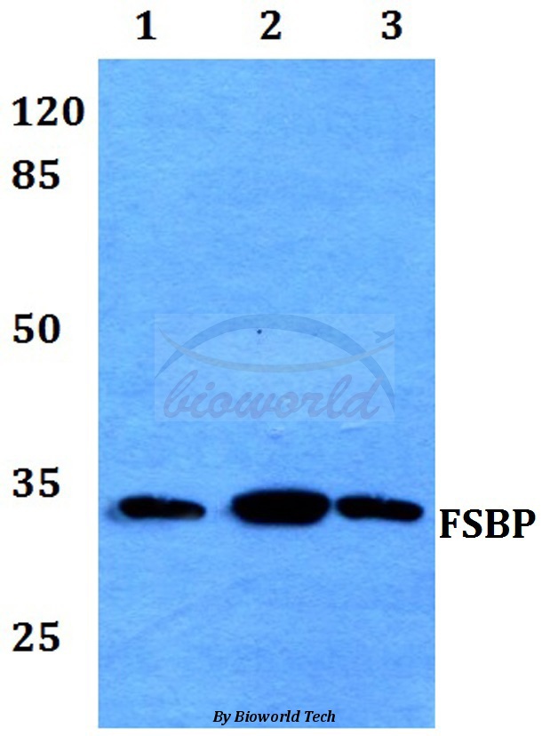 Western blot (WB) analysis of FSBP pAb at 1:500 dilution Lane1:HEK293T whole cell lysate Lane2:NIH-3T3 whole cell lysate Lane3:Mouse stomach tissue lysate