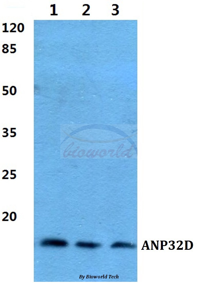 Western blot (WB) analysis of ANP32D pAb at 1:500 dilution Lane1:Hela whole cell lysate Lane2:Mouse liver tissue lysate Lane3:Rat iver tissue lysate