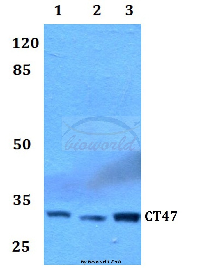 Western blot (WB) analysis of CT47 pAb at 1:500 dilution Lane1:HEK293T whole cell lysate Lane2:Raw264.7 whole cell lysate Lane3:PC12 whole cell lysate