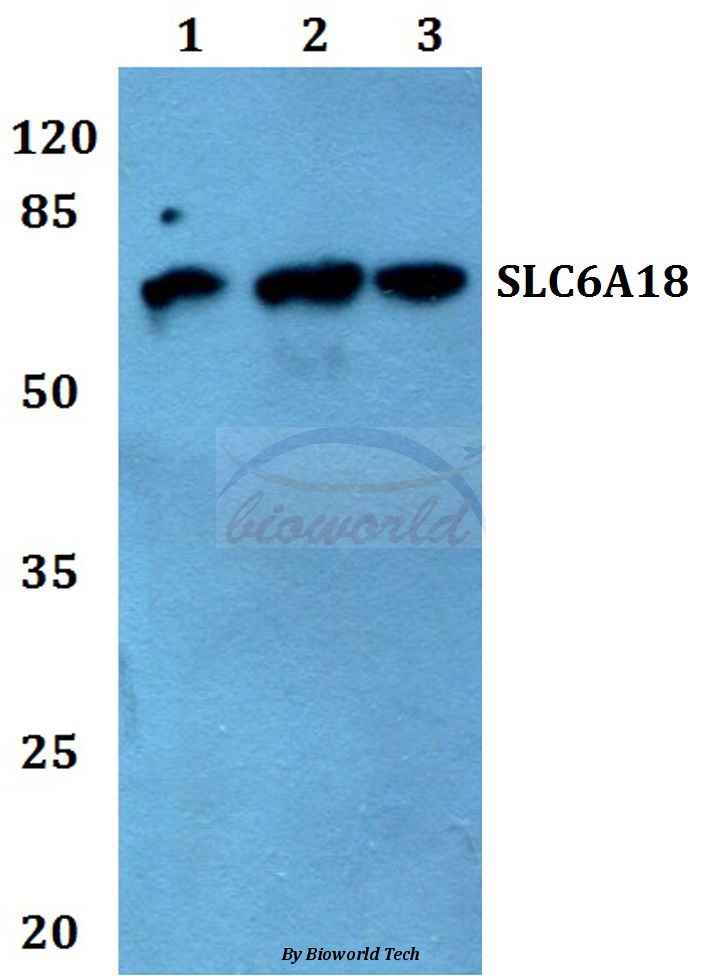 Western blot (WB) analysis of SLC6A18 pAb at 1:500 dilution Lane1:THP-1 whole cell lysate Lane2:Raw264.7 whole cell lysate Lane3:PC12 whole cell lysate