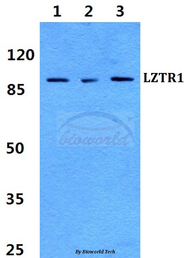 Western blot (WB) analysis of LZTR1 pAb at 1:500 dilution Lane1:MCF-7 cell lysate Lane2:Raw264.7 cell lysate Lane3:PC12 cell lysate
