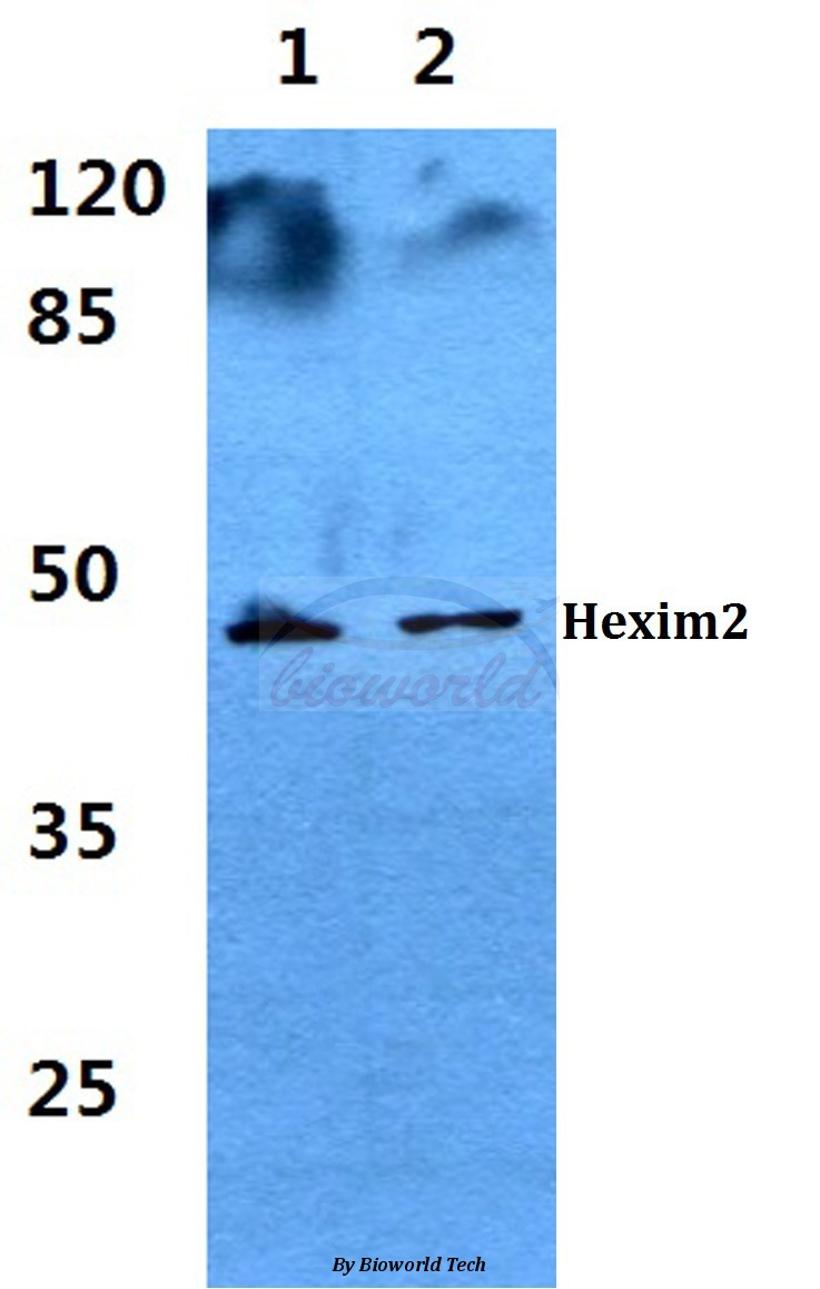 Western blot (WB) analysis of Hexim2 pAb at 1:500 dilution Lane1:HEK293T cell lysate Lane2:A549 cell lysate