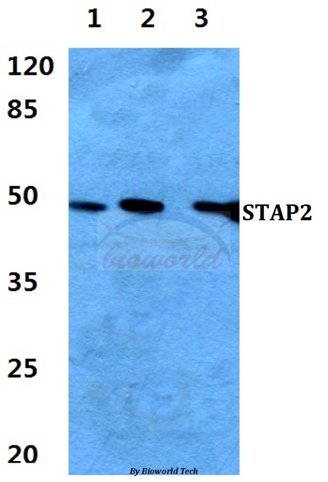 Western blot (WB) analysis of STAP2 pAb at 1:500 dilution Lane1:HEK293T cell lysate Lane2:sp2/0 cell lysate Lane3:PC12 cell lysate