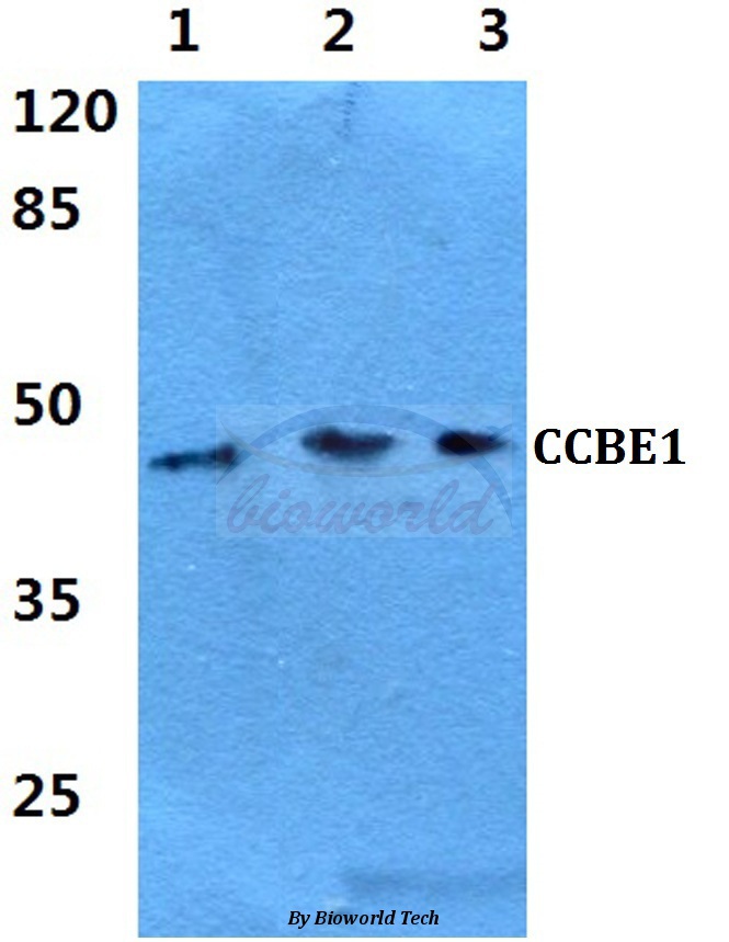 Western blot (WB) analysis of CCBE1 pAb at 1:500 dilution Lane1:Hela cell lysate Lane2:sp2/0 cell lysate Lane3:PC12 cell lysate