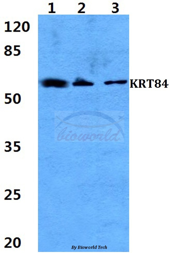 Western blot (WB) analysis of Cytokeratin 84 pAb at 1:500 dilution Lane1:THP-1 cell lysate Lane2:Raw264.7 cell lysate Lane3:PC12 cell lysate