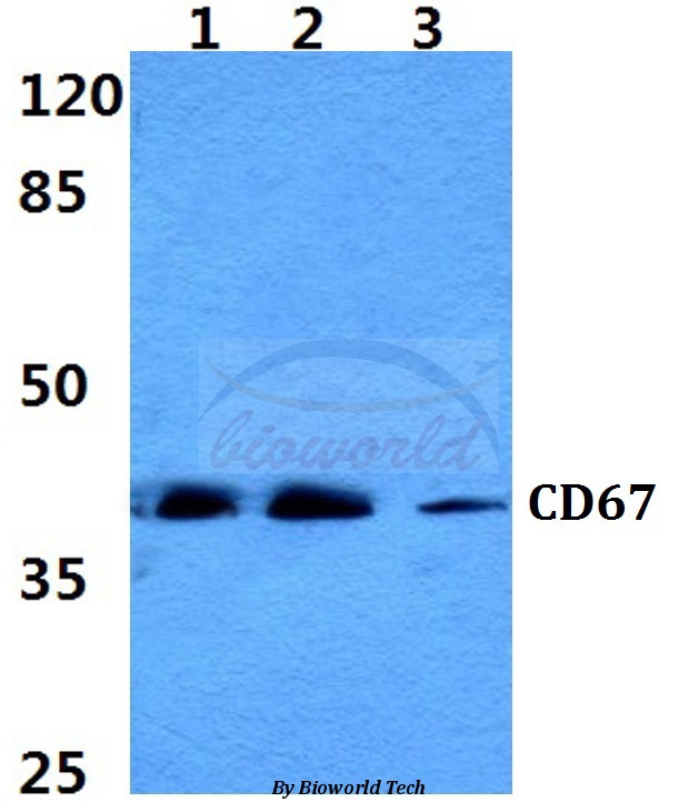 Western blot (WB) analysis of CD67 pAb at 1:500 dilution Lane1:MCF-7 cell lysate Lane2:NIH-3T3 cell lysate Lane3:PC12 cell lysate