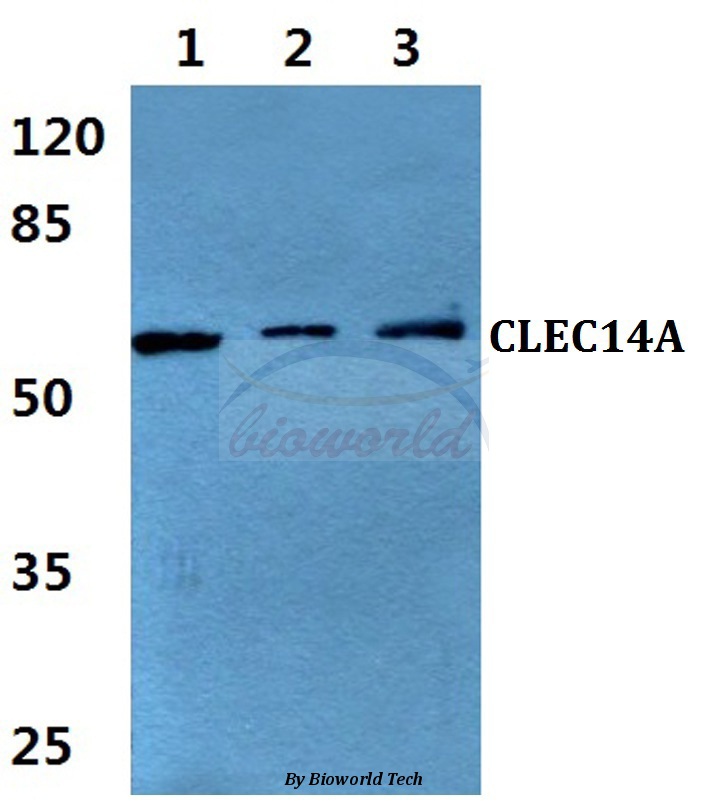 Western blot (WB) analysis of CLEC14A pAb at 1:500 dilution Lane1:HEK293T cell lysate Lane2:Raw264.7 cell lysate Lane3:Rat liver tissue lysate