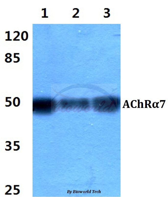 Western blot (WB) analysis of AChRα7 pAb at 1:500 dilution Lane1:Jurkat cell lysate Lane2:Raw264.7 cell lysate Lane3:Rat liver tissue lysate