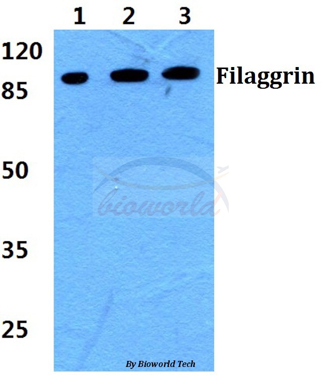 Western blot (WB) analysis of Filaggrin pAb at 1:500 dilution Lane1:Hela cell lysate Lane2:sp2/0 cell lysate Lane3:PC12 cell lysate